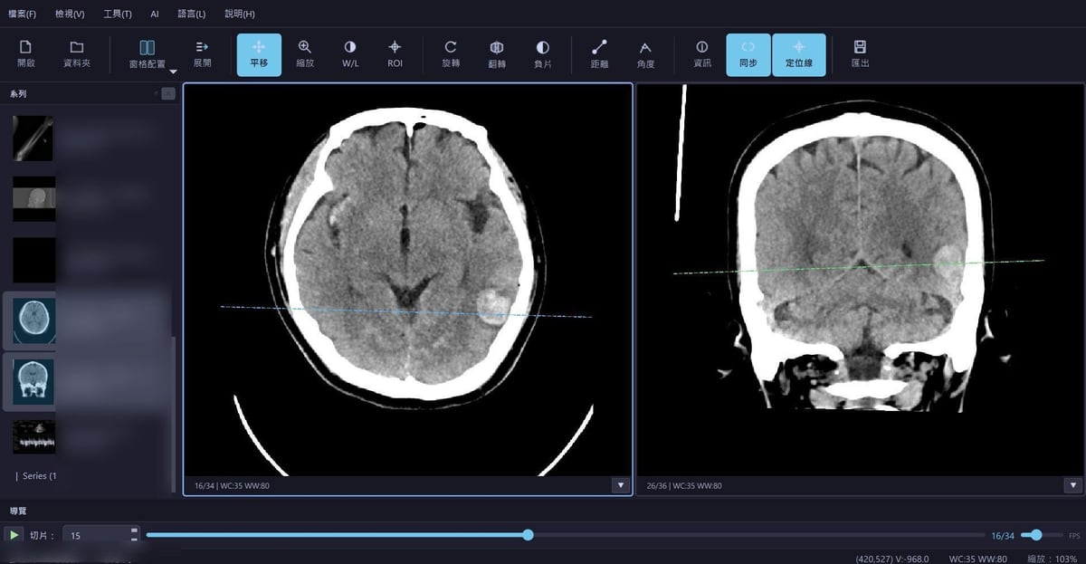 DICOM Viewer